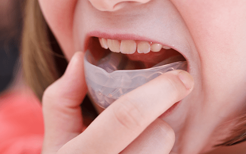 歯並びの予防
