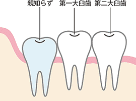 正常なタイプ