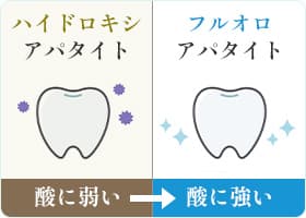 歯質の強化